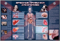 Электрифицированный стенд "Вредные привычки: алкоголизм" - «globural.ru» - Хабаровск